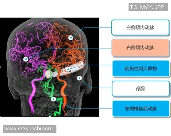 TES战术解析:深入探讨英雄联盟中的防反体系与实战应用